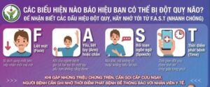 đột quỵ não