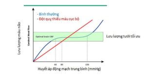 Cơ chế tự điều hòa lưu lượng máu não