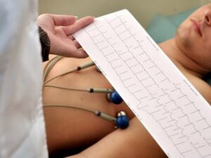 ECG điện tâm đồ điện tâm đồ