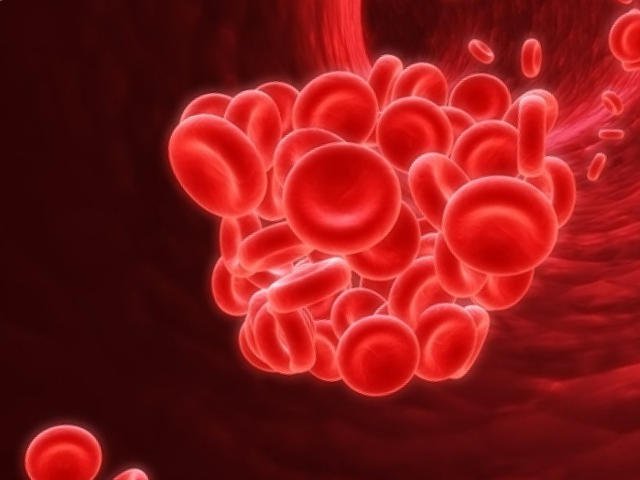 Hội chứng kháng phospholipid làm tăng đông máu quá mức